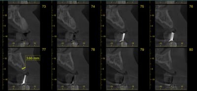 Scan1 acqmf2 - Eugenol