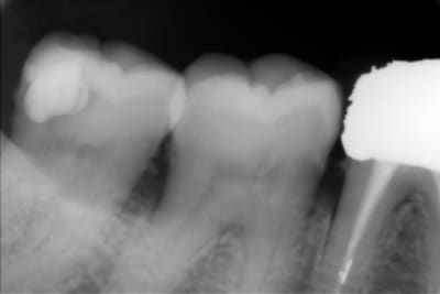 Sensible xjiks3 - Eugenol