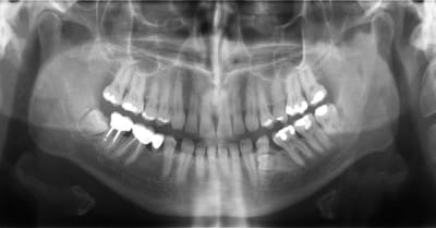 Sans titre 1 gopkyk - Eugenol