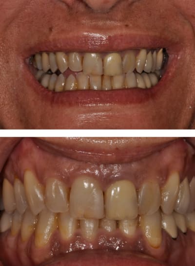 Sans titre 1 kiha3j - Eugenol