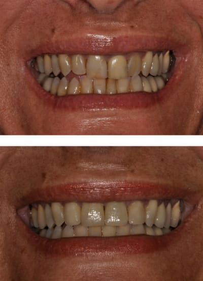 Sans titre 5 ojh0wm - Eugenol