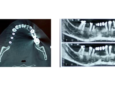 Sans titre - Eugenol