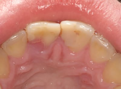 Sans titre bpmtrg - Eugenol