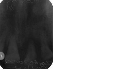 Sans titre fyux4a - Eugenol