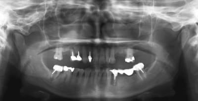 Sans titre gggvja - Eugenol