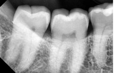 Sans titre qwkfon - Eugenol