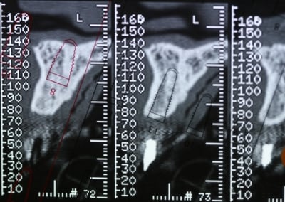 Scann21 i8lpnl - Eugenol
