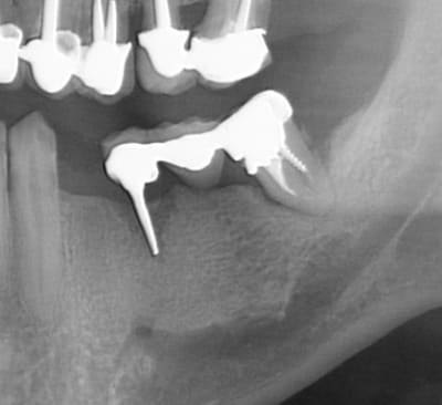 Screenshot118 iylxui - Eugenol