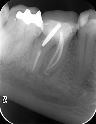Screenshot122 dglot4 - Eugenol