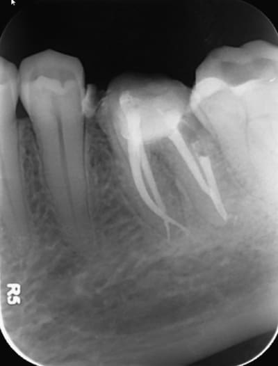 Screenshot123 axujoi - Eugenol