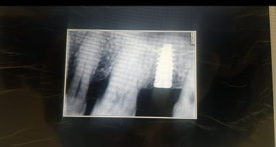 Screenshot 20200820 190633 messenger jsghah kqchfg - Eugenol