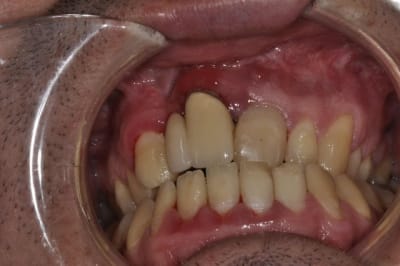 Situation initiale rz0zjn - Eugenol