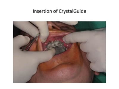 Slide27 oqavqw - Eugenol