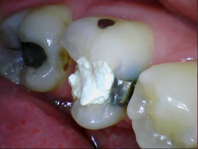 Stillcap0006 alfeak - Eugenol