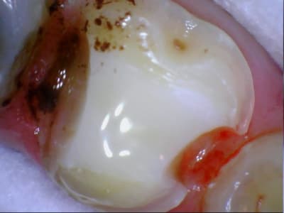 Stillcap0012 w4dgkg - Eugenol