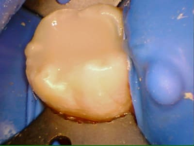 Stillcap0016 zf06b6 - Eugenol