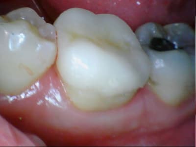 Stillcap0030 ccv7io - Eugenol