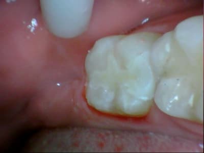 Stillcap0047 ducllg - Eugenol