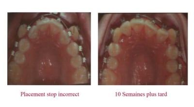 Stops 1 vnymmp - Eugenol