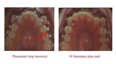 Stops 2 gn6ur5 - Eugenol