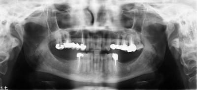 Synapse 36164340430774  2  dr6yqd - Eugenol