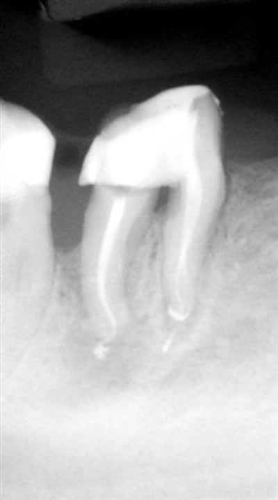 Tr sur 46 uhb8ch - Eugenol