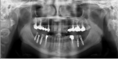 Ted chris3 fke9yo - Eugenol