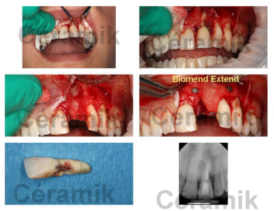 Une 21  montage  macwl0 - Eugenol