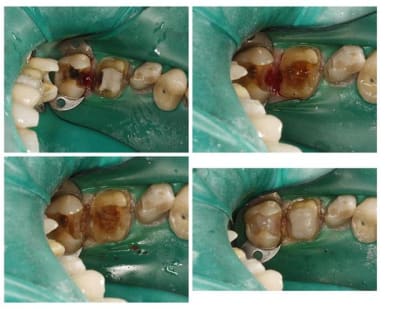 Untitled  large  h7agii - Eugenol