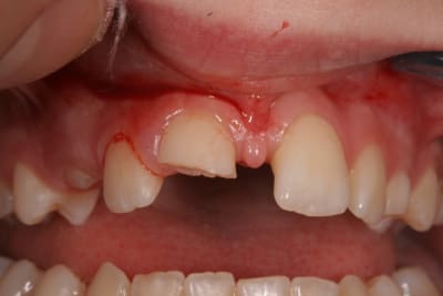 Vrac 441 uhqtsw - Eugenol