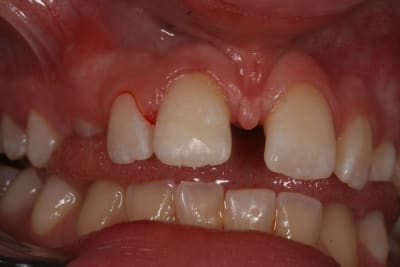 Vrac 449 gn8tnp - Eugenol