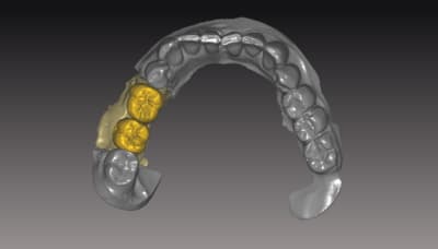 Vueoc hrkdso - Eugenol