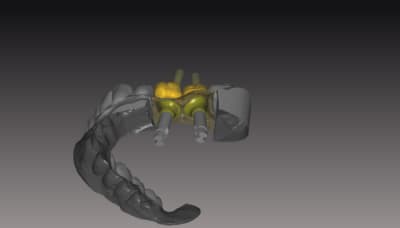 Vue emergence uvtieo - Eugenol