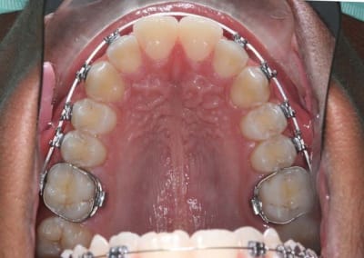 Vue o - Eugenol