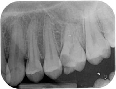 Waveone26pr  ttdafm - Eugenol