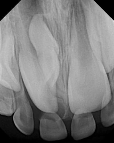 X19123 1 gdya3h - Eugenol