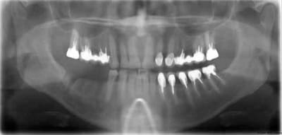 Xav1 steakn - Eugenol