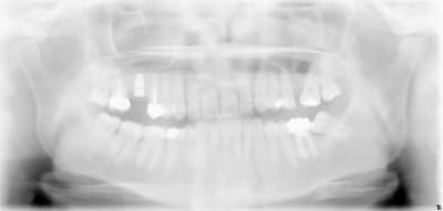 Xxx2 bmbs2m - Eugenol