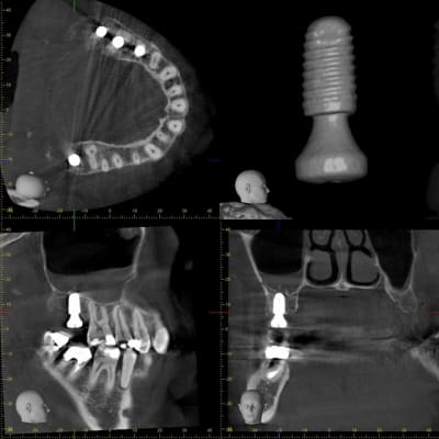 Xyzview 20151217 134 hby6nd - Eugenol