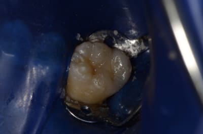  dsc1708 tbx338 - Eugenol