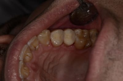  dsc1710 qkinhu - Eugenol