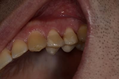  dsc1712 lfyfhn - Eugenol