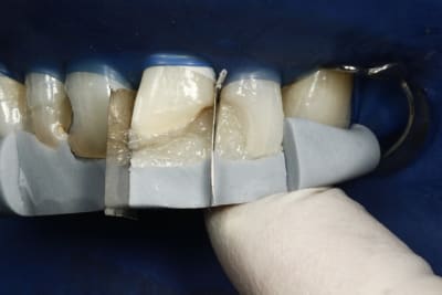  mg 1435 i0qllq - Eugenol