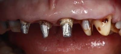  mg 1637 obyjap - Eugenol