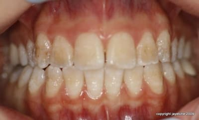  mg 1778 e0bxab - Eugenol