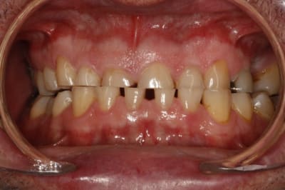  mg 1814  1024x768  gb3cgi - Eugenol