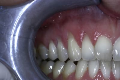  mg 2034 t9gkuj - Eugenol