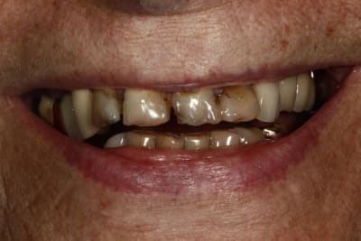  mg 2052 ebvnuy - Eugenol