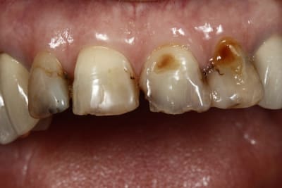  mg 2055 wxlicp - Eugenol