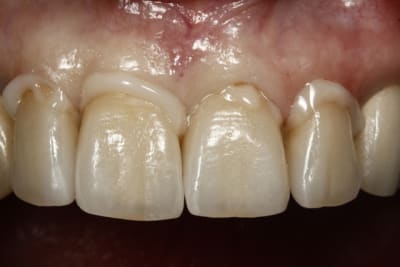  mg 2118 xzdu1z - Eugenol